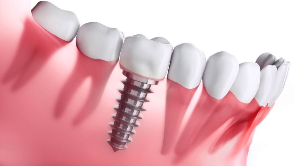 Restorative Dentistry (1)