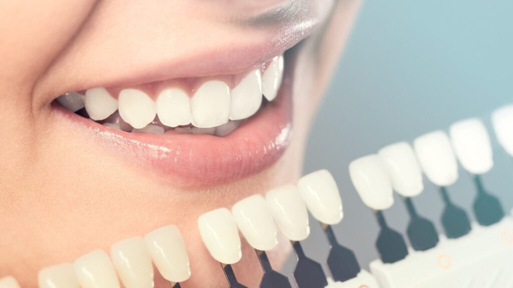 cosmetic dentistry (3)